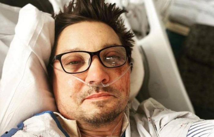 Jeremy Renner, sources close to the ‘Avengers’ star: he risks having his leg amputated