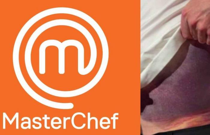 Serious accident for MasterChef judge: “A miracle alive” | The shocking photos of the accident
