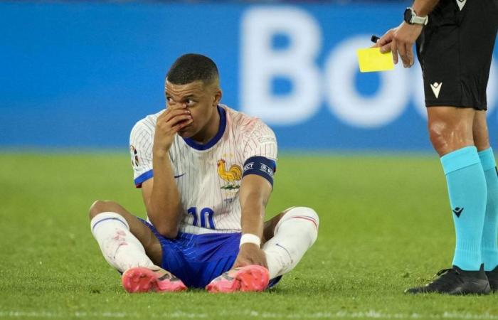 Mbappé, broken nose but no operation: when will he be able to return to the pitch