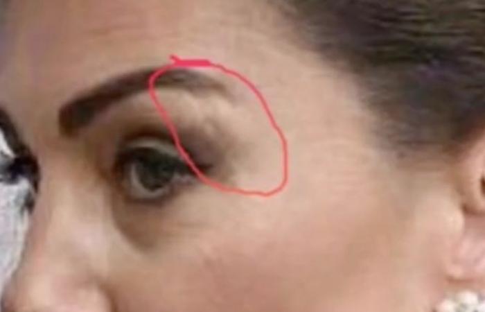 Kate returns to public but the scar on her face scares everyone: what’s wrong with her?