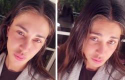 ”I slept for 48 hours straight, my face is completely free of make-up”: Belen shows herself without make-up after the food poisoning that left her knocked out – Gossip.it