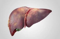 Liver Problems in the Elderly: How to Prevent and Manage Them