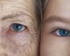 Vision problems that may indicate the development of dementia 12 years before diagnosis
