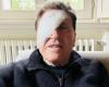 Gianni Morandi on social media with one eye bandaged – Very true
