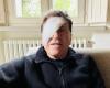 Gianni Morandi with one eye bandaged on social media. Fear for the singer