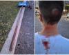 Signage pole comes loose and hits child on the head, near tragedy in Pozzuoli